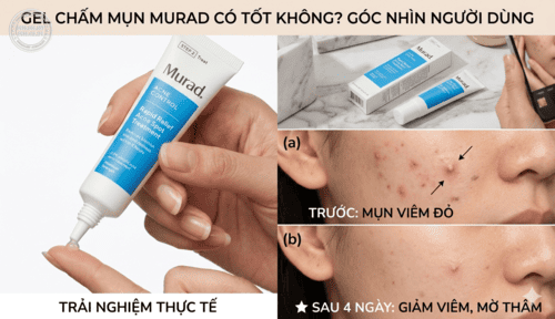 Gel chấm mụn Murad có tốt không? Góc nhìn người dùng